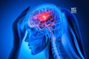 Cómo reconocer y prevenir un accidente cerebrovascular en la oficina