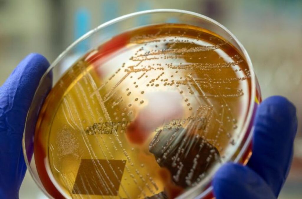 ¿Qué se sabe sobre la bacteria carnívora de Japón? 1