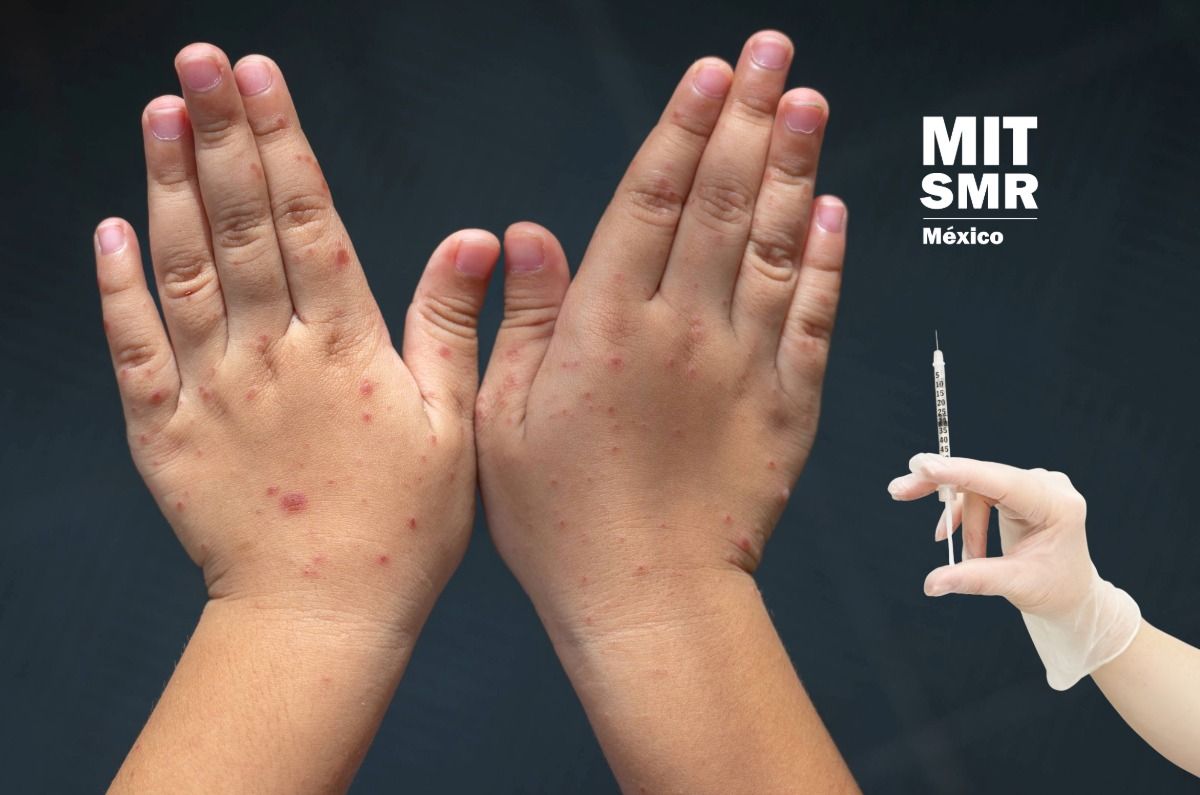 sarampion-en-la-oficina-el-brote-que-puede-frenar-tu-empresa-si-ignoras-los-datos